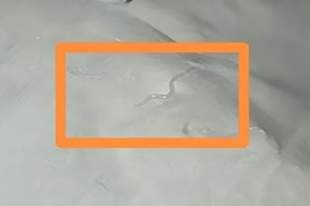 小朋友容易中招！妈妈半夜发现女儿肛周竟有“白色粉末”，送医检查后倒吸一口凉气……