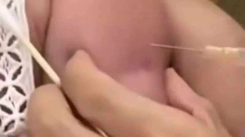 江苏一护士戴手链美甲给宝宝接种疫苗，针头完全扎入胳膊被质疑不专业，卫生院：涉事护士暂时停止调岗