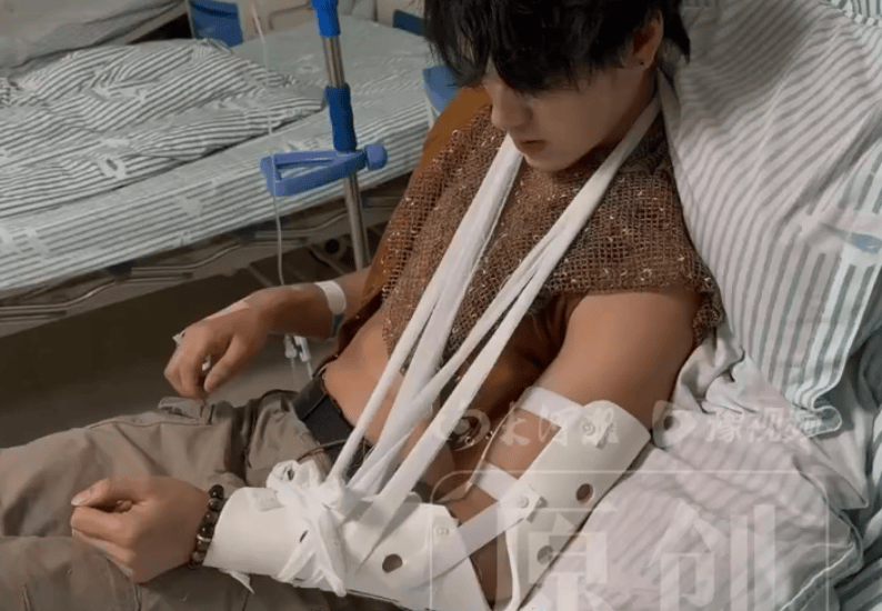 一景区NPC与游客互动被掰断手臂:对方提出掰手腕,突然发力导致其胳膊骨折并晕倒