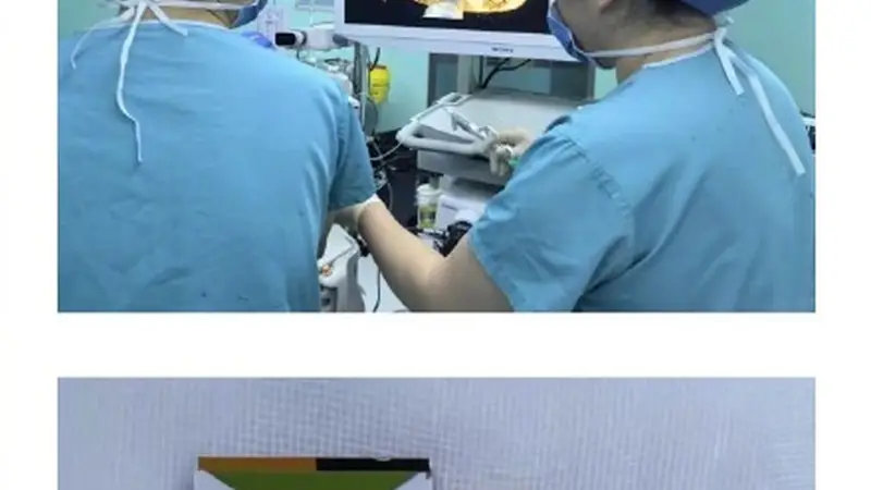 5岁女童不慎吞了50克金条