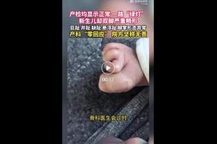 产检一路“绿灯”，宝宝出生后双脚却严重畸形，医院回应：按筛查标准不检查四肢，属于医学盲区，主张无责任