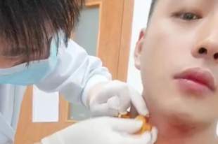 男子被蚊子叮咬脖子,抓挠后血流1小时不止,足足400毫升,当事人最新发声;接诊医生称“第一次遇到”,可能和刚健身完有关