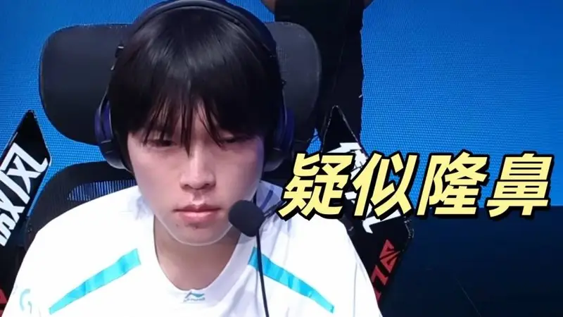 疑似Bin隆鼻被网友发现，对比6月有明显变化，而且脸也瘦了不少