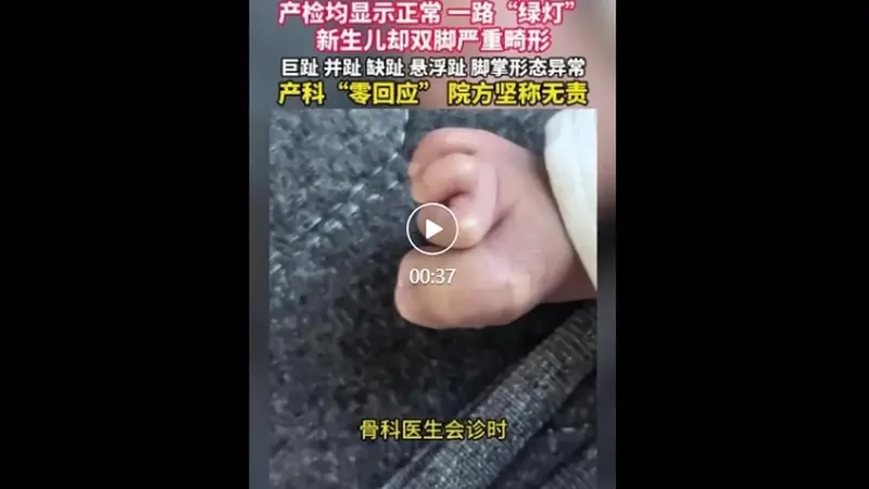 产检一路“绿灯”，宝宝出生后双脚却严重畸形，医院回应：按筛查标准不检查四肢，属于医学盲区，主张无责任
