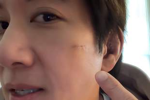 王力宏伤口即将拆线，宣布下一站开始取消威亚装置